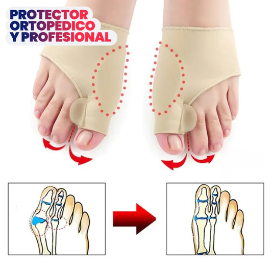 Corrector de Juanetes - Hallux™