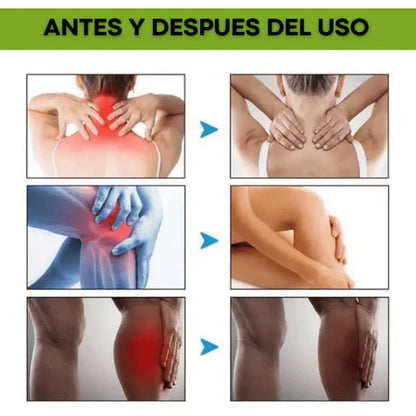 2x1 beevana  🐝 -  Crema De veneno de abeja DILE ADIOS A LOS DOLORES  + ENVIO GRATIS TODO GUATEMALA🎁