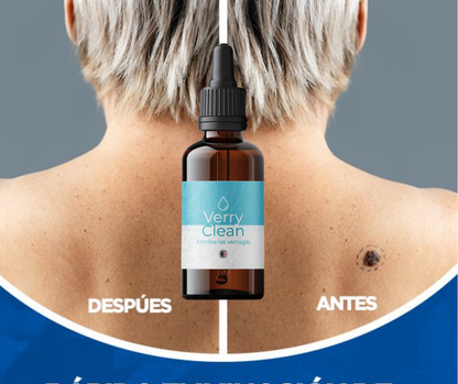 PROMO RELAMPAGO⚡ 2x1 Elimina Verrugas con Verryclean+Envio Gratis