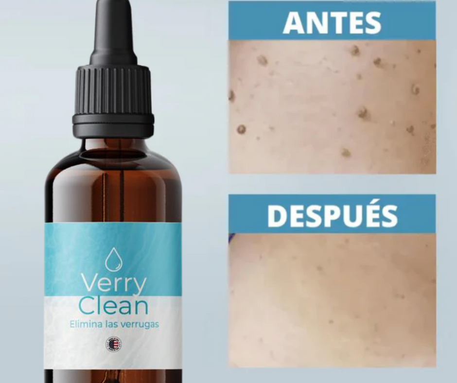 PROMO RELAMPAGO⚡ 2x1 Elimina Verrugas con Verryclean+Envio Gratis