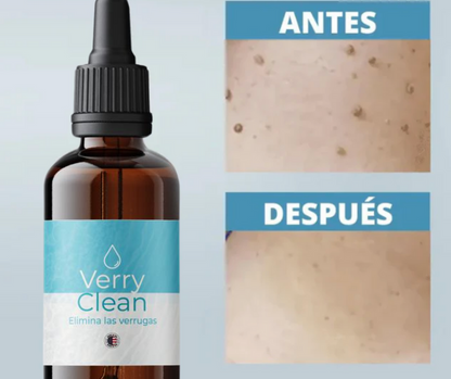 PROMO RELAMPAGO⚡ 2x1 Elimina Verrugas con Verryclean+Envio Gratis