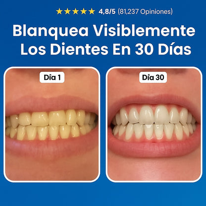 Reparación Odontológica Nudenta – Escudo Dental Avanzado