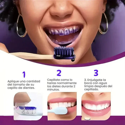 Blanqueador Dental V34™  - ¡Dientes más blancos al instante!  + Envío gratis🎁