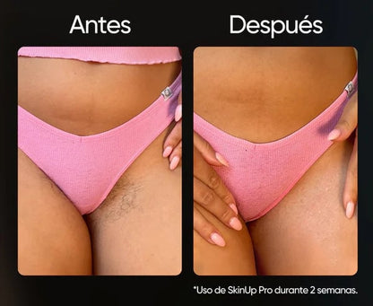 Depiladora Láser Ipl Permanente + ENVIO GRATIS