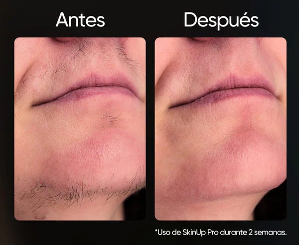 Depiladora Láser Ipl Permanente + ENVIO GRATIS