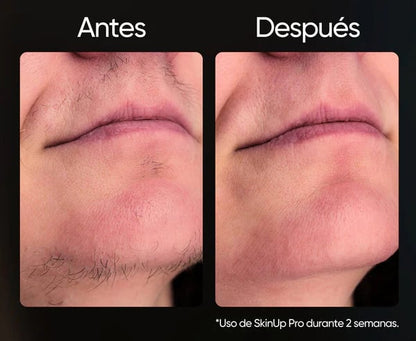 Depiladora Láser Ipl Permanente + ENVIO GRATIS